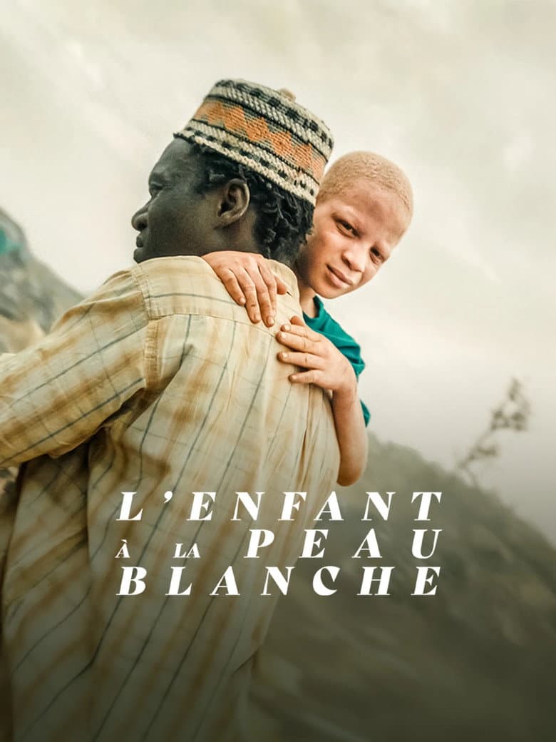 L'Enfant à la Peau Blanche