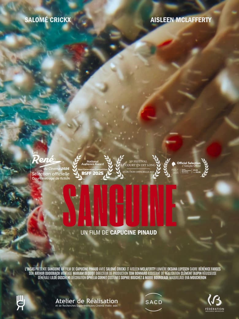Sanguine