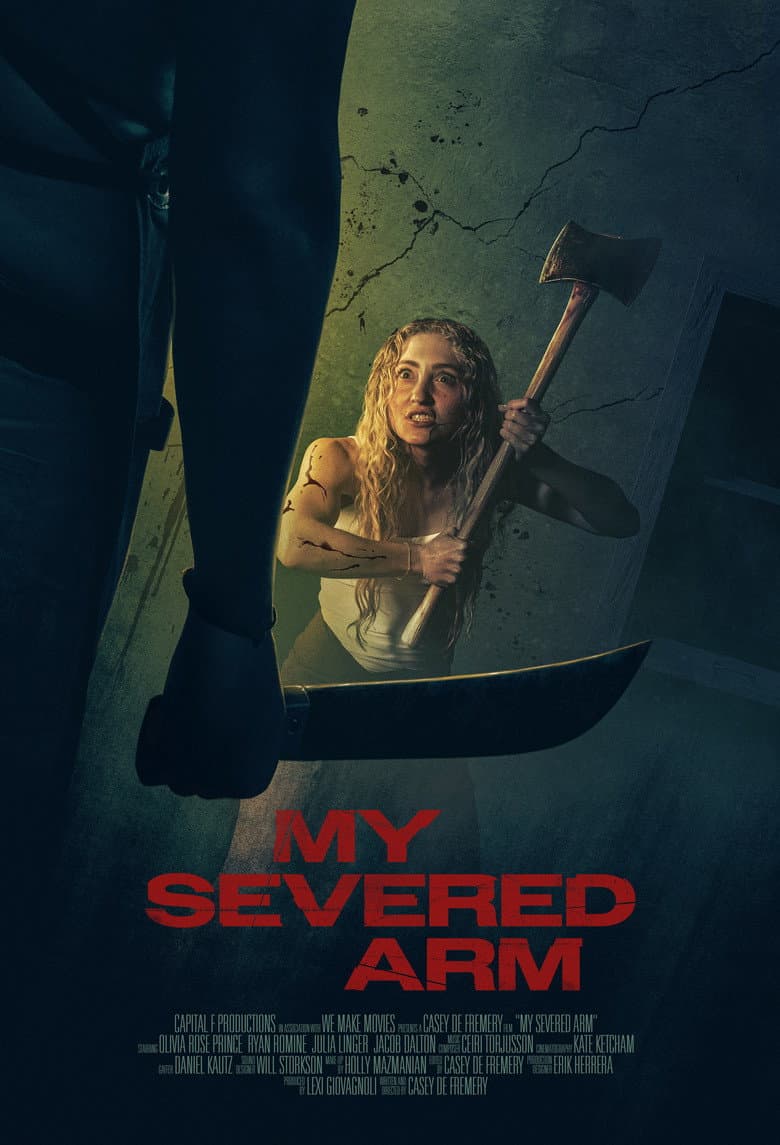 My Severed Arm